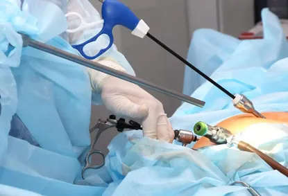 Ovarian Cyst Laparoscopic Surgery & Treatment: Antibiotics, Dermoid Cysts & Recovery Guide